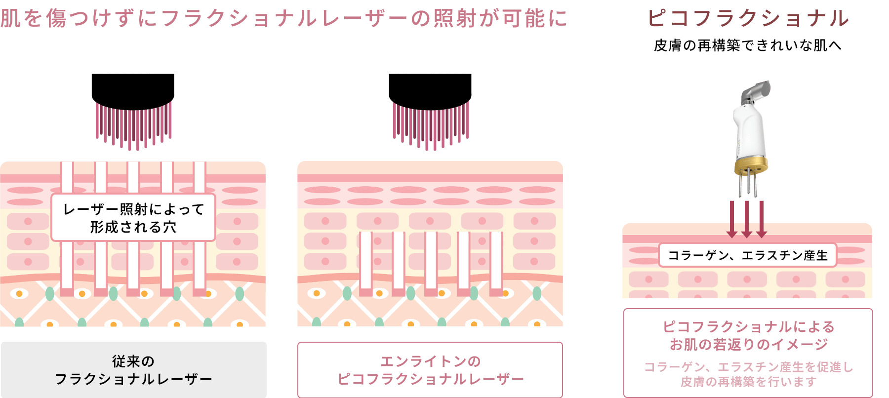 ピコフラクショナルとは