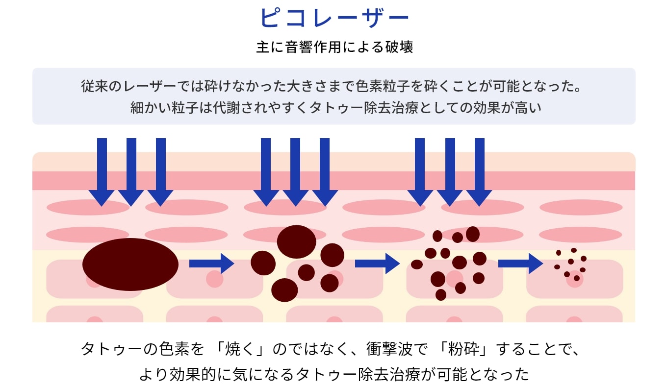 Point１：綺麗に除去